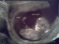 ultrasound baby #2 12 weeks.jpg