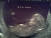 ultrasound baby #2 12 weeks #2.jpg