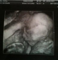 Myprincess22weeks.jpg