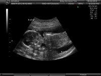 baby16weeks.jpg