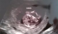 Baby 12 weeks hand.jpg