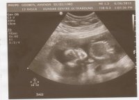 baby2-4.jpeg.jpg