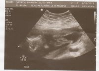 baby2-5.jpeg.jpg