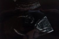 20 week scan.jpg