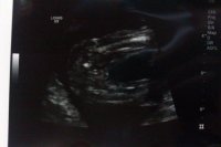 20 week scan2.jpg