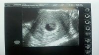 Baby Sears 6w 4d.jpg