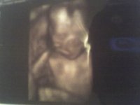 20weeks.jpg