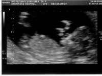 Baby2.jpg
