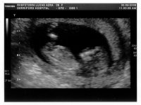 Baby4.jpg