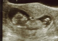 edited 12 Week Scan 1.jpg