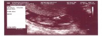12 weeks 4 days scan.jpg