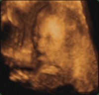 Baby04.jpg