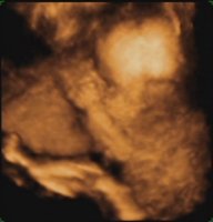 Baby08.jpg