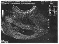 6 weeks 6 days (4).jpg
