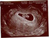 jellybean_8weeks.jpg
