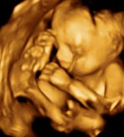 UC BABY_0010.jpg