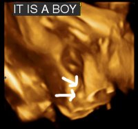 boy.jpg