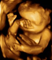 UC BABY_0015.jpg