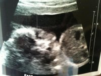 20 week 003.jpg