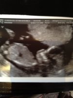 baby Engleburt 13 weeks.JPG