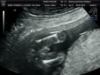 BABYBOND_9.jpg