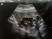 its a boy.jpg