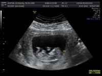11-12 weeks_2.jpg