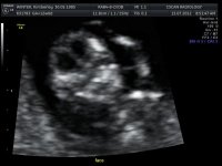 11-12 weeks_15.jpg