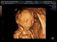BABY_15.jpg