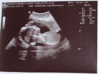 baby1-2.jpg