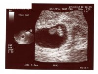 7weeks.jpg