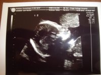 19wk5day T2.jpg