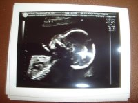 19wks 5days T1.jpg