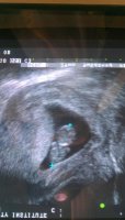 babym9w5d.jpg