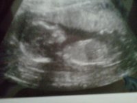 Baby Dionna 17+4.jpg