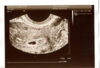 scan 5+1.jpg