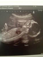 21wks2.jpg