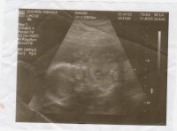Baby2-8.jpg