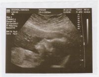 baby2-9.jpg