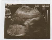 Baby2-10.jpg