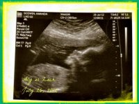 Baby2-10 Mandy.jpg