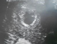 lilfella6w1d.jpg