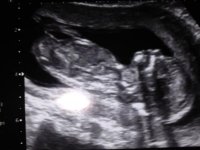 baby.jpg