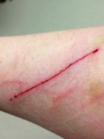 scratches.jpg