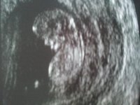 11 weeks side_opt-1.jpg