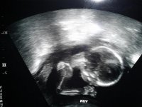 Baby 18 weeks.jpg