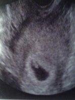 1st Scan Photo Closeup.jpg