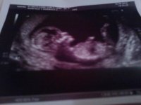 scan baby2.jpg