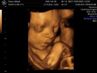 BABY ABIGAIL_7.jpg