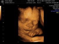 BABY ABIGAIL_30.jpg